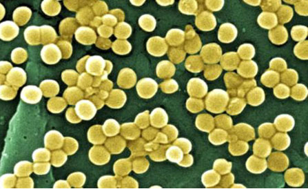 顯微鏡下的“超級病菌”NDM-1。