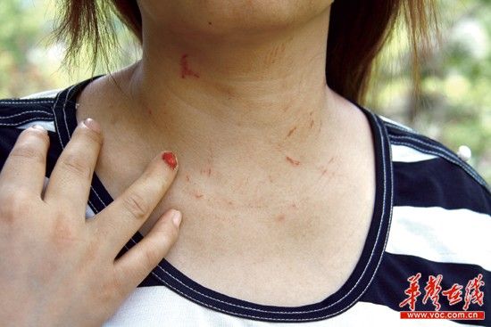 妻子現(xiàn)場(chǎng)抓住小三 竟被丈夫開車拖行百米