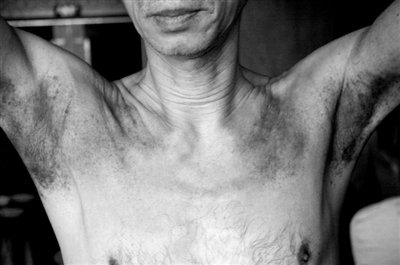 神醫(yī)全國開連鎖年賺千萬 稱拍打拉筋治百病