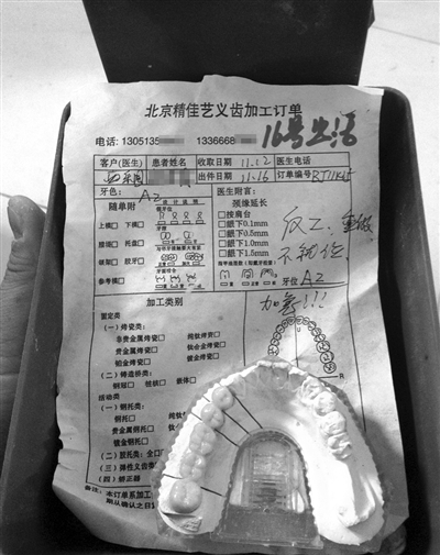 精佳藝義齒加工訂單顯示“反（返）工、重做”等字樣，一名骨干業(yè)務(wù)員說(shuō)，該廠產(chǎn)品返工率占兩成。