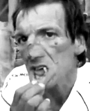 邊裁的鼻子被打破，牙齒幾乎被打得掉光了