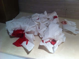 血浸透多重紗布。